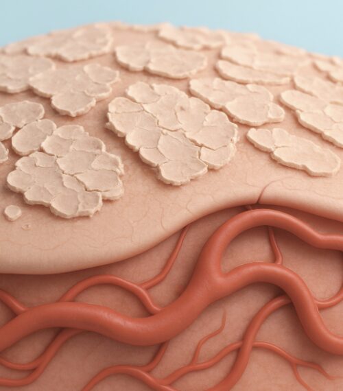 Psoriasis – Aufbau der Haut bei Schuppenflechte | Börner Lebenswerk